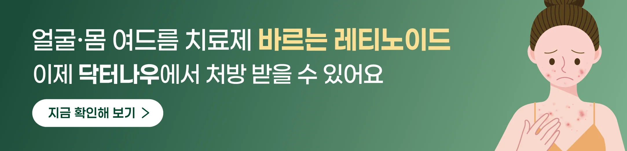 배너 722x174 dp
